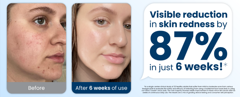 How does Clean Skin Club Clean Towels XL work