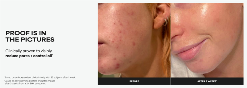 The Secret to Smoother & Brighter Skin