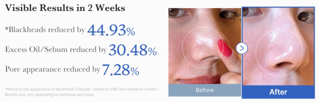 Why Many Users Prefer Medicube Zero Pore Pad 2.0